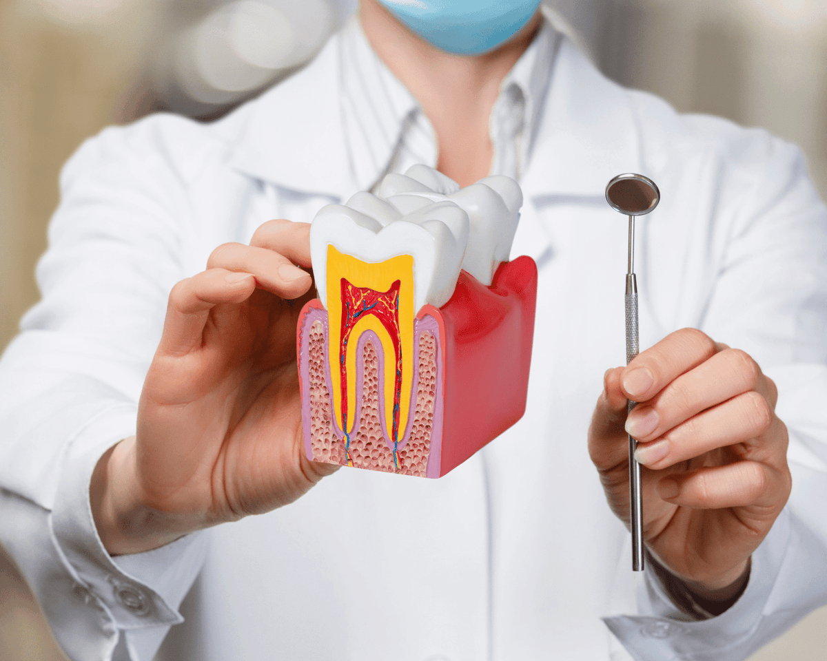 Tratamento de canal em Joinville - Prodentex